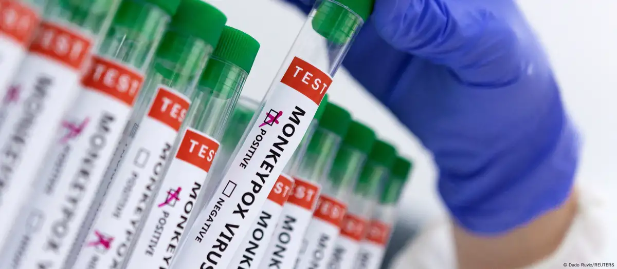 Argentina descarta caso de Mpox en Buque carguero