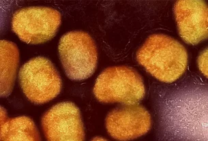 Suecia confirma primer caso de variante peligrosa de mpox