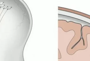 Neuralink probará chip cerebral para mover brazos robóticos