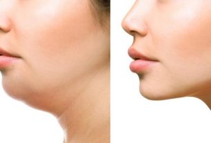 Puede la dieta influir en el desarrollo de la mandíbula