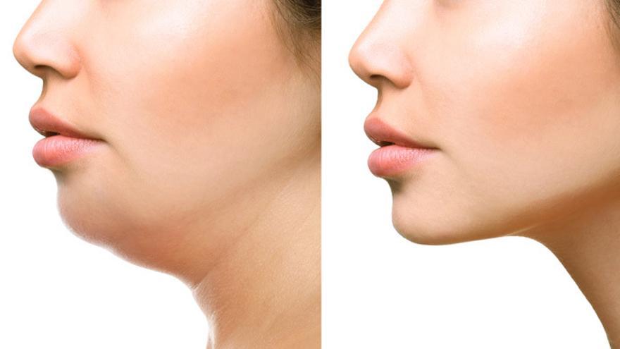 Puede la dieta influir en el desarrollo de la mandíbula