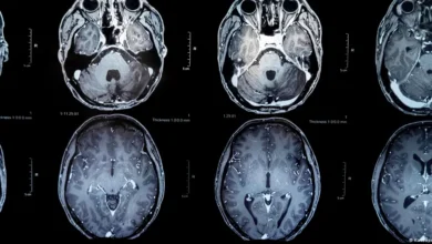 Vacuna contra tumores cerebrales da nueva esperanza