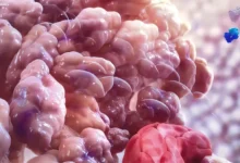 Descubren cómo el cáncer puede resistir la inmunoterapia