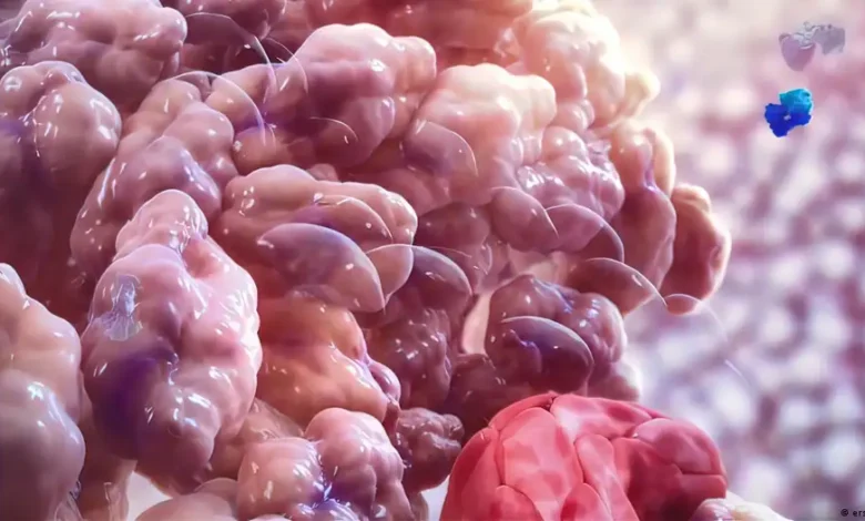 Descubren cómo el cáncer puede resistir la inmunoterapia