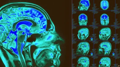Mapa celular del cerebro revela claves de enfermedades